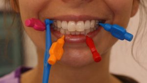 Use of Inter-dental Brushes for a Healthy Smile